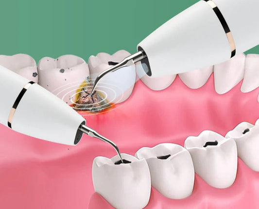 Limpador dental ultrassônico, clareamento dental elétrico, vibração de alta frequência para remoção de manchas de placa de cálculo, escova de dente