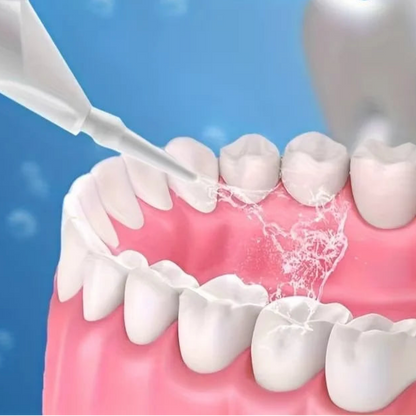 Irrigador oral de alta pressão doméstico portátil dentes limpos água fio dental manual palito de água de alta pressão